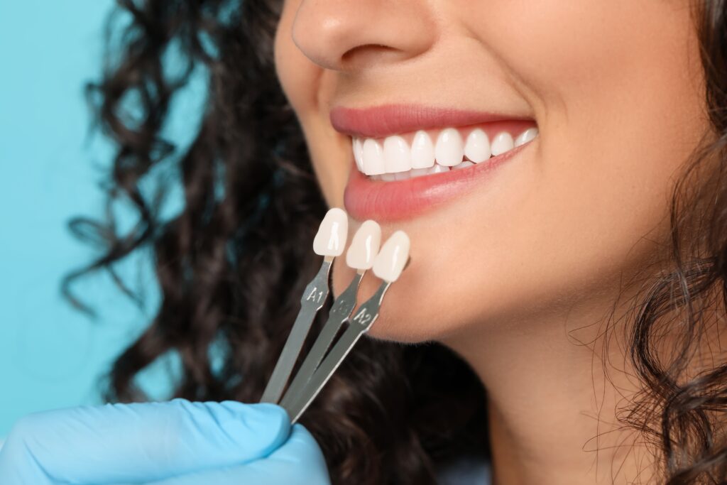 Dental Veneers LaFollette